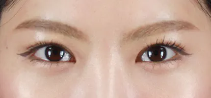 前后照片 2