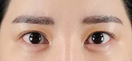 前后照片 2