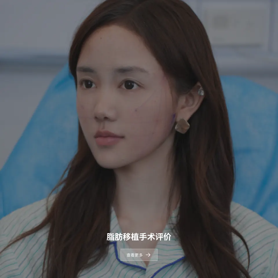 肉毒素注射后记 1