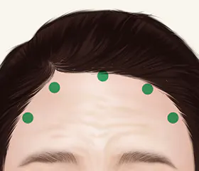 当眉毛位置较低,眼睛到眉毛的距离较窄时