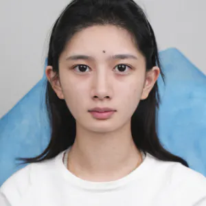 长颌矫正 6