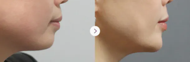 鼻 6