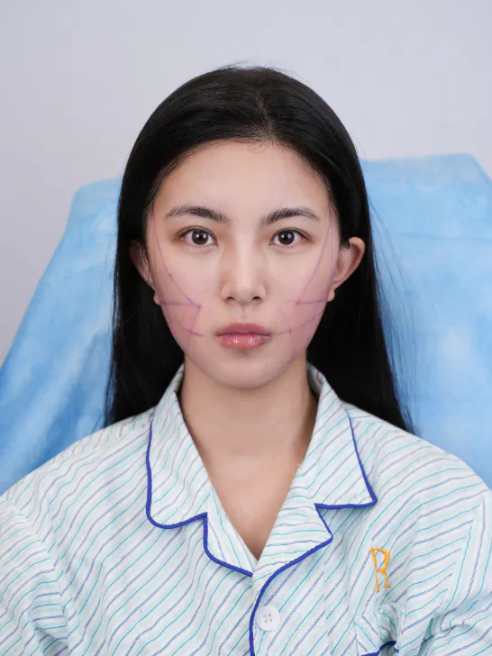 项目影像参考 3