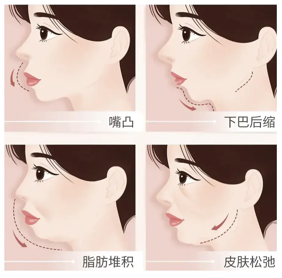 整体协调与个体化设计