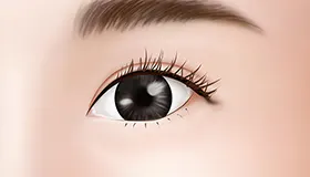 手术方法 1
