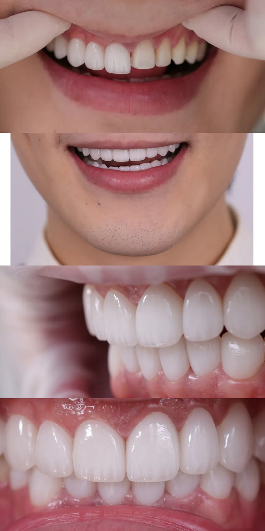 项目影像参考 5