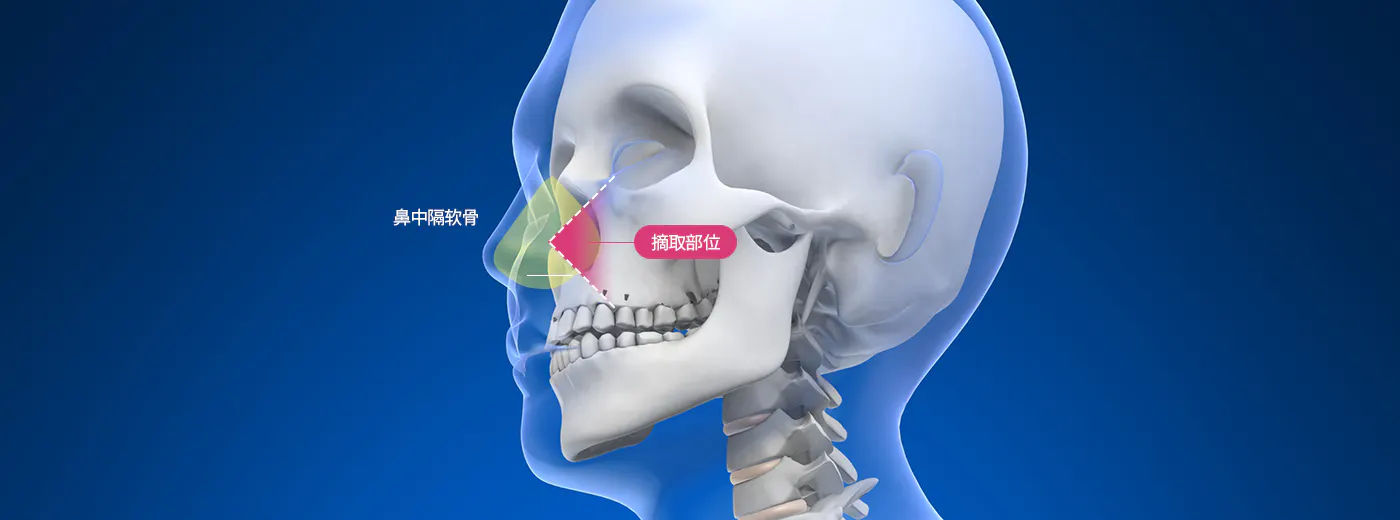 自体软骨 1