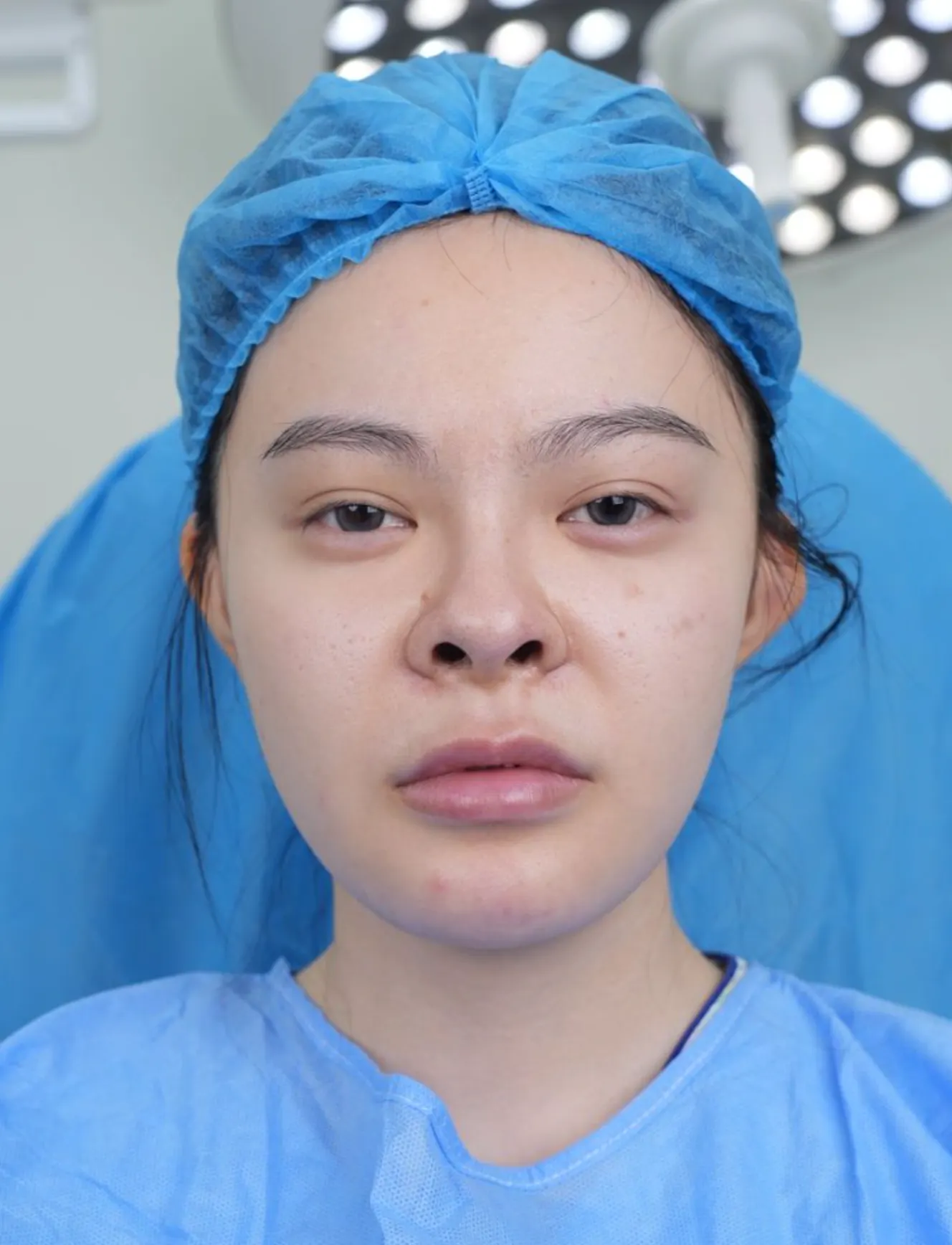 前后照片 1