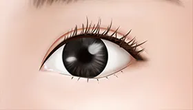 手术方法 5