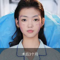 注射提升 · 项目影像参考 02