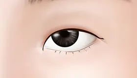 手术方法 1