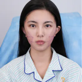 下垂 1
