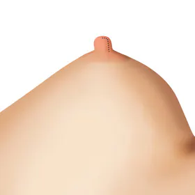 手术方法 3