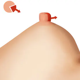 手术方法 2