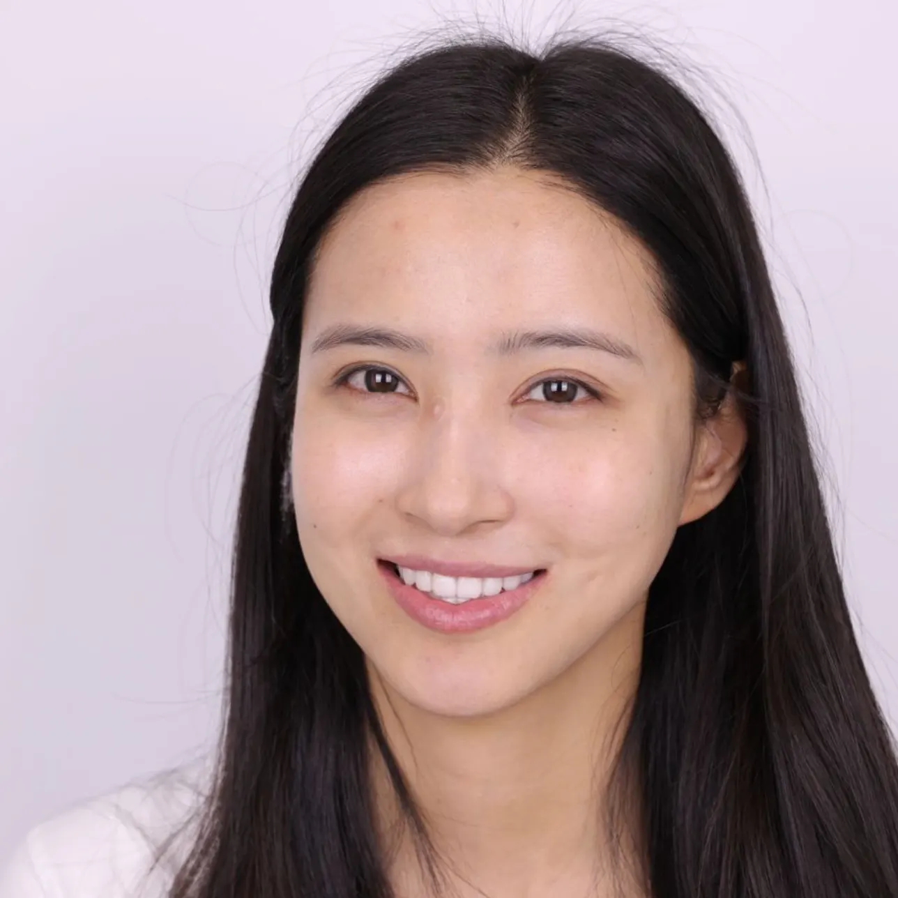 恒温皓齿美白疗程后记 1
