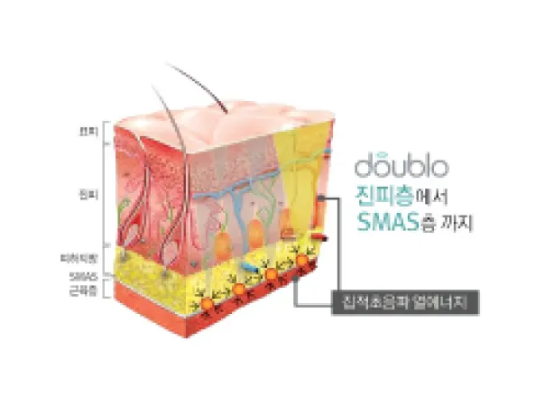 REAL Doublelo Gold Lifting 1