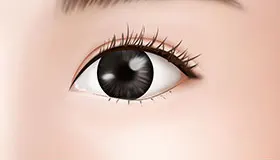 手术方法 5