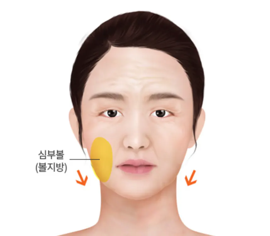 我年轻的时候 3