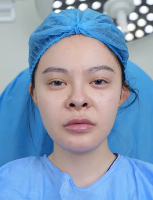 项目影像参考 1
