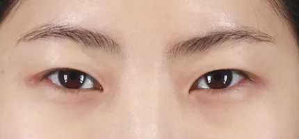 前后照片 1