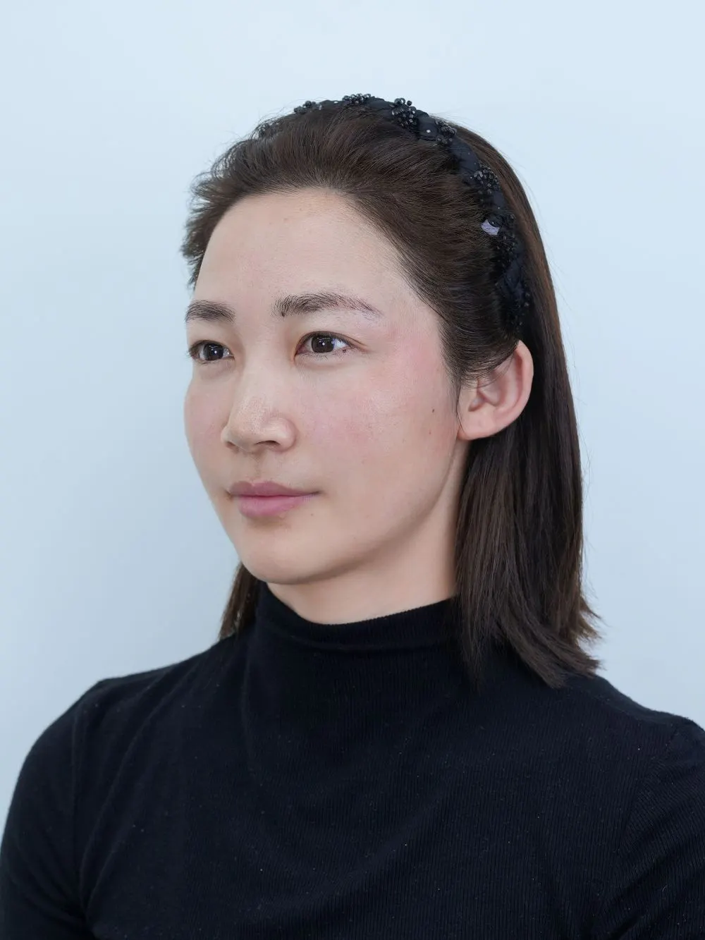 REAL面部轮廓手术 · 项目影像参考 03