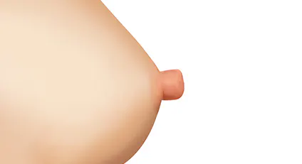 塑造美丽胸部，同时改善功能 3