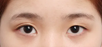 前后照片 1