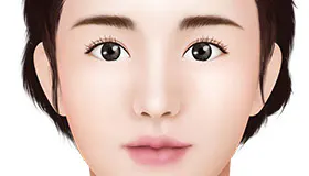 眼形矫正 5
