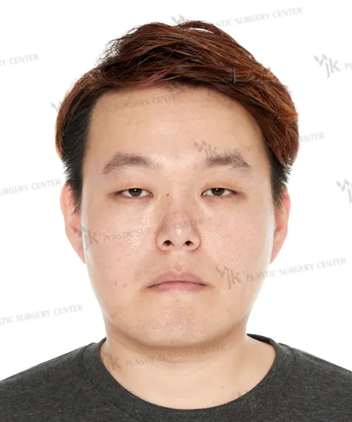 项目影像参考 3