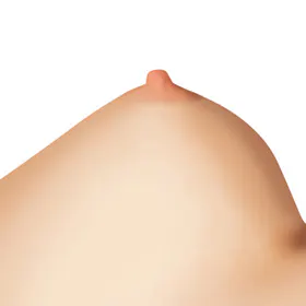改善乳头重度内陷的手术方法 4