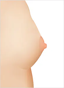 全面、均匀、精细的注入 · 项目影像参考 01