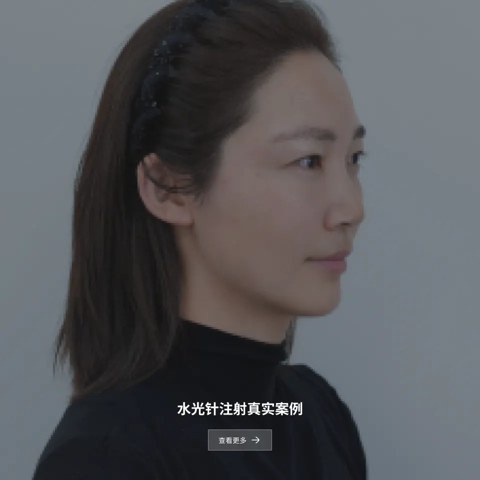 水光针注射后记 2