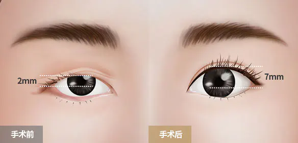 项目介绍