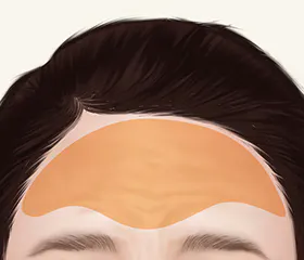 眼睑看起来肿胀
