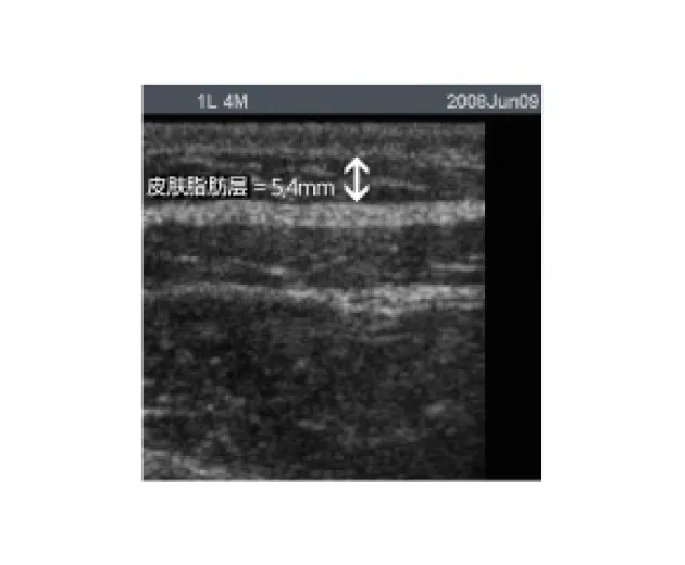 施术原理与效果 7