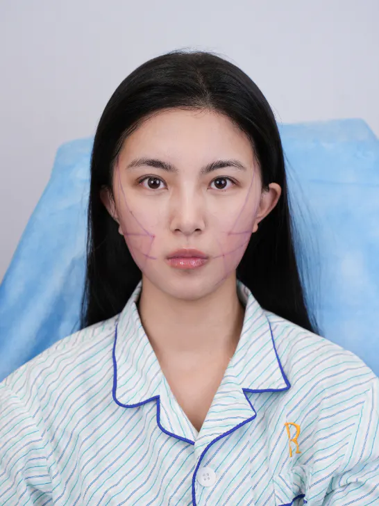 项目影像参考 3