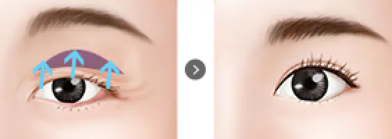 紋眉的人 医疗团队照片