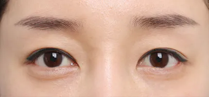 前后照片 2
