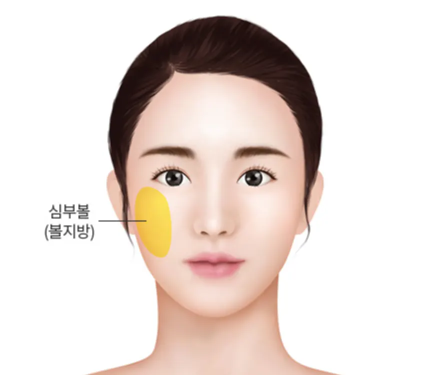 我年轻的时候 1