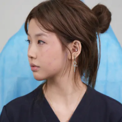 REAL提拉手术 1