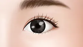 手术方法 3