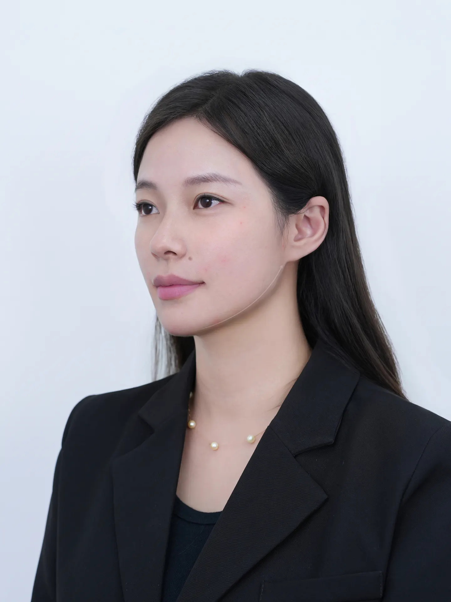 3D-H鼻部整形手术后记 1