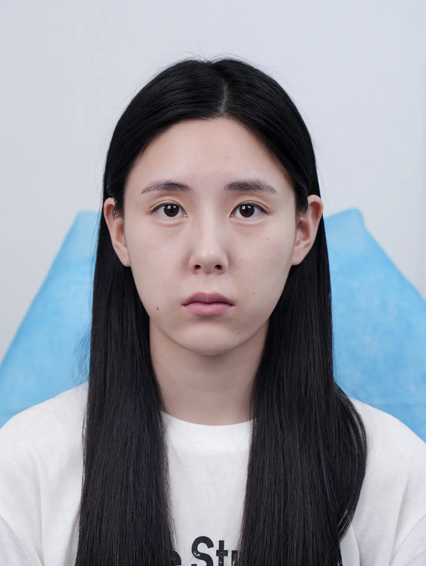 REAL脂肪填充，用存活率证明 1
