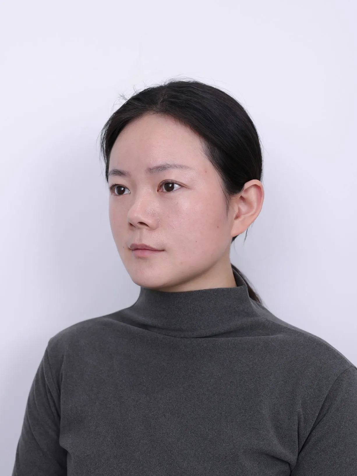 方颌整形