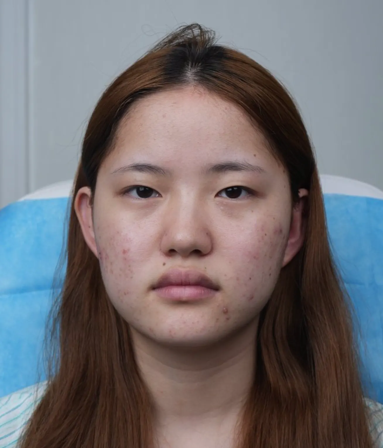 前后照片 1
