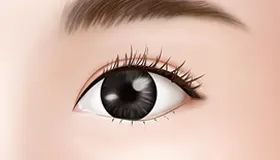 手术方法 3