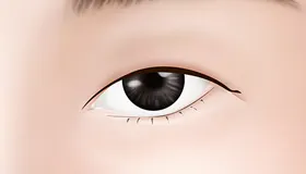 手术方法 1