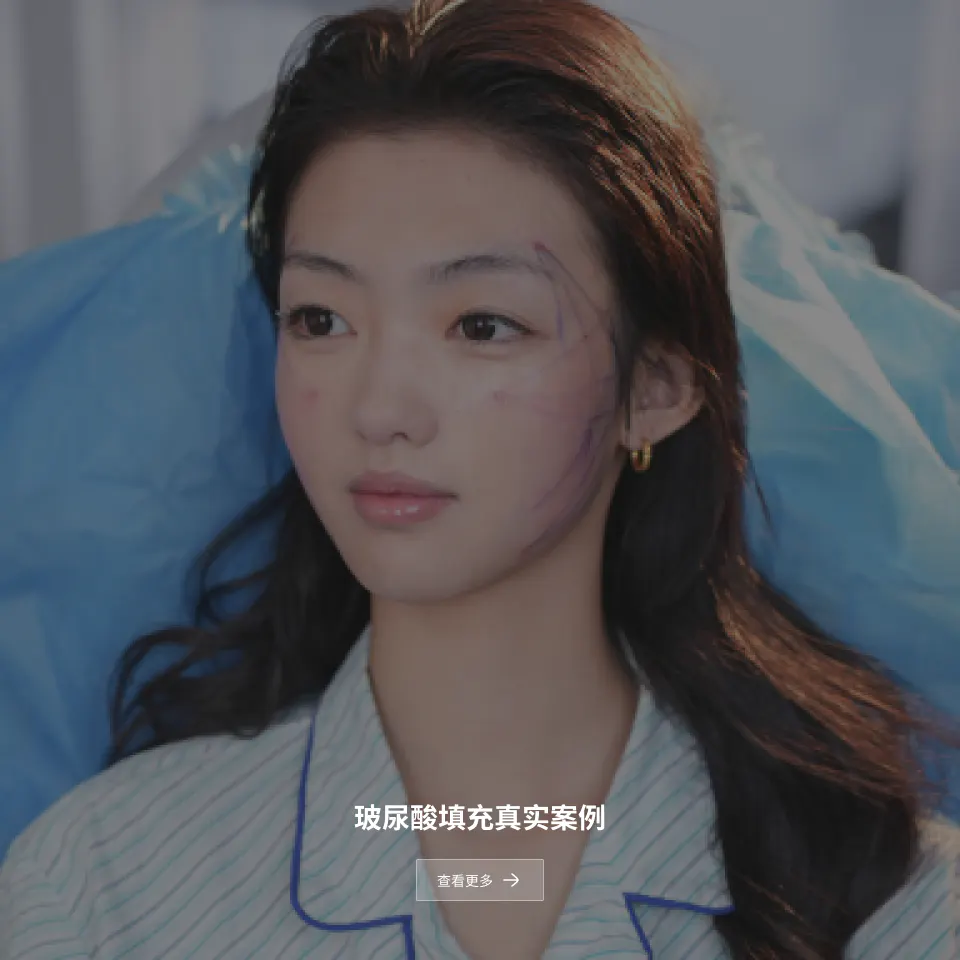 玻尿酸填充后记 2