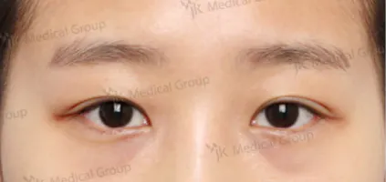 项目影像参考 2