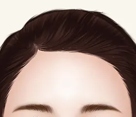 麻醉方法